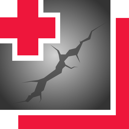 Strive Cement Crack Repair